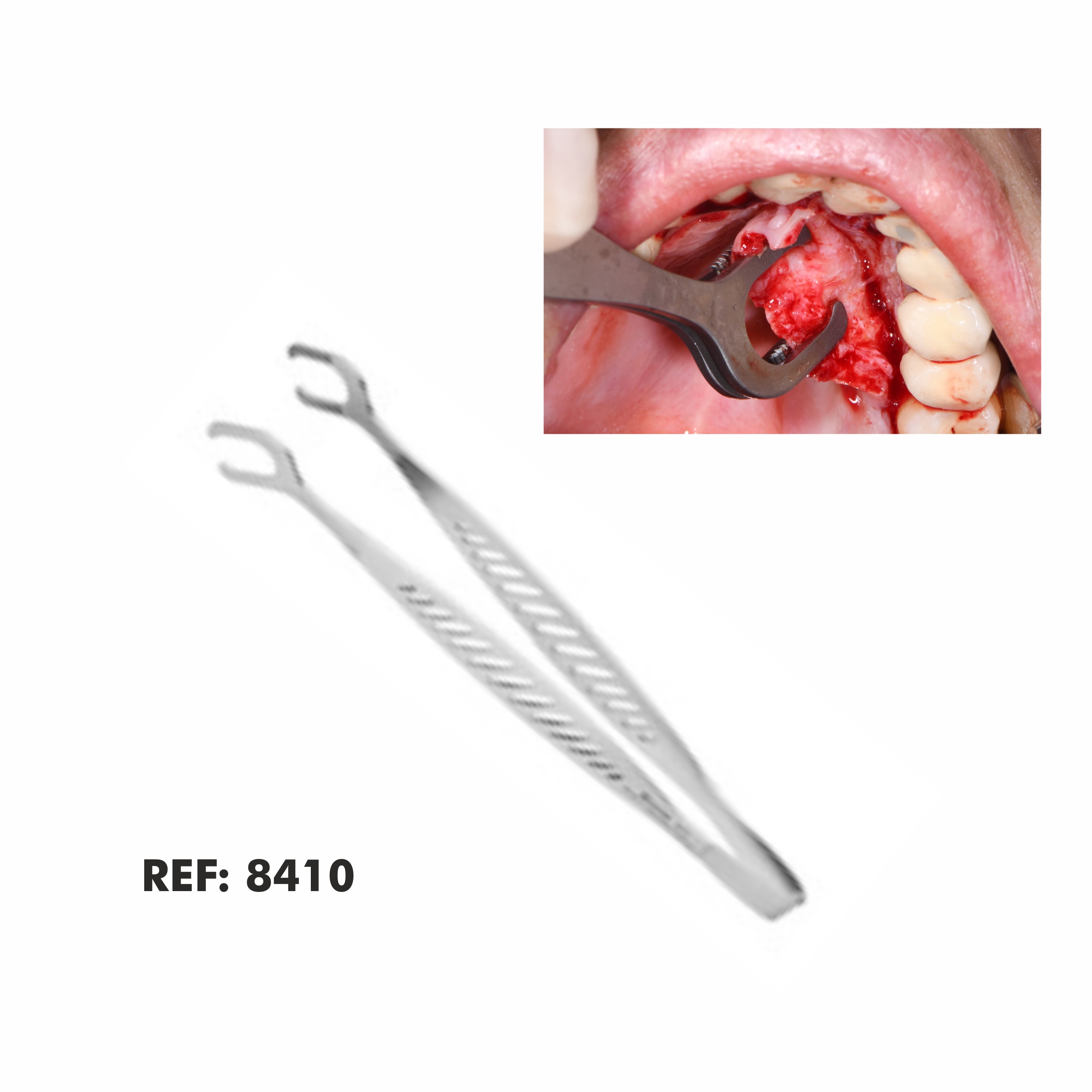 Pinza Flap
